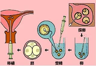 胚胎移植后会不会自己流出来