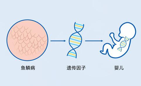 怎样避免家族性鱼鳞病遗传给下一代?