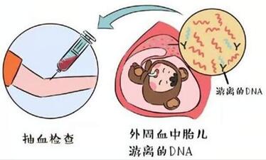 nt与唐筛哪个准确率高?NT和唐筛有什么区别!